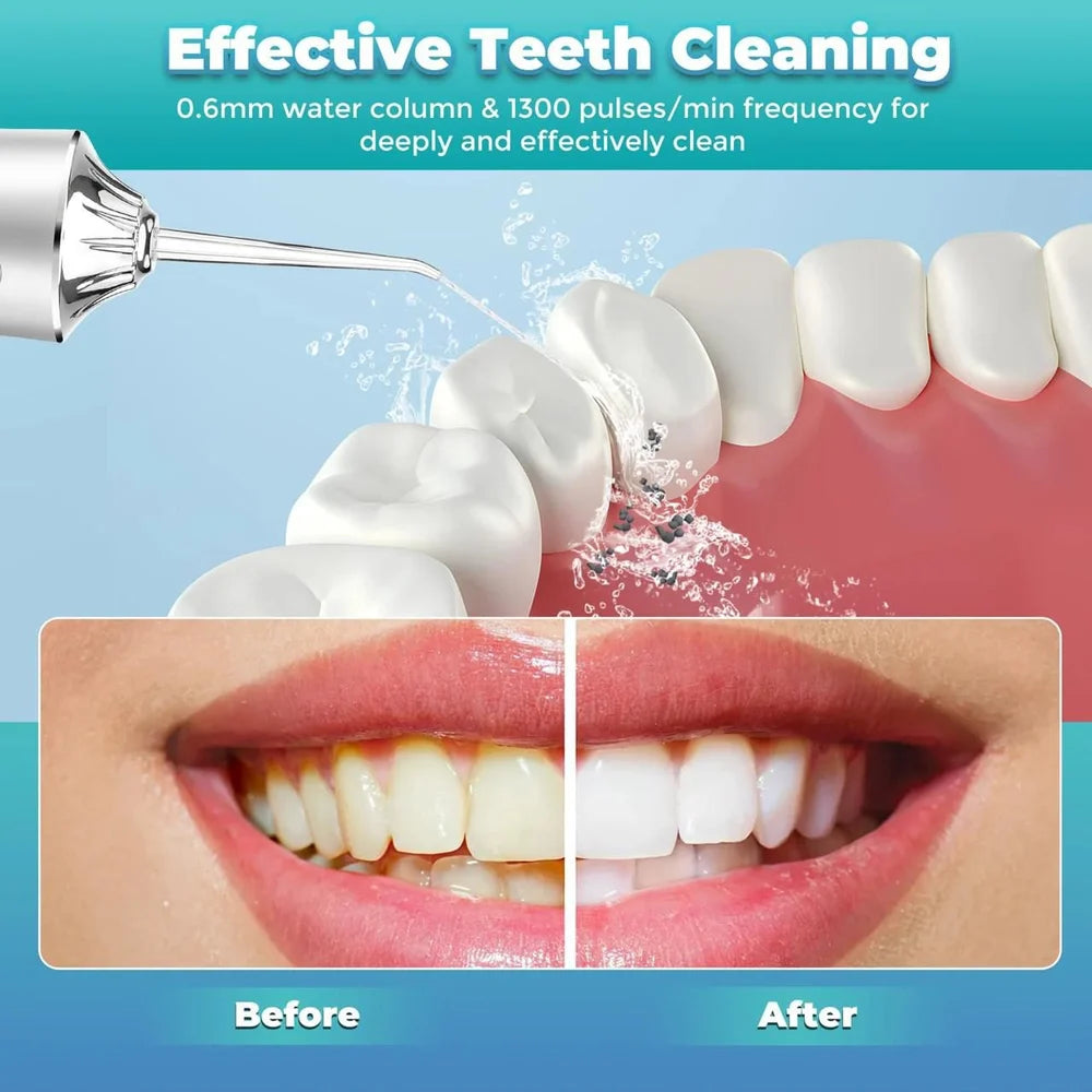 Water Flosser for Oral Hygiene